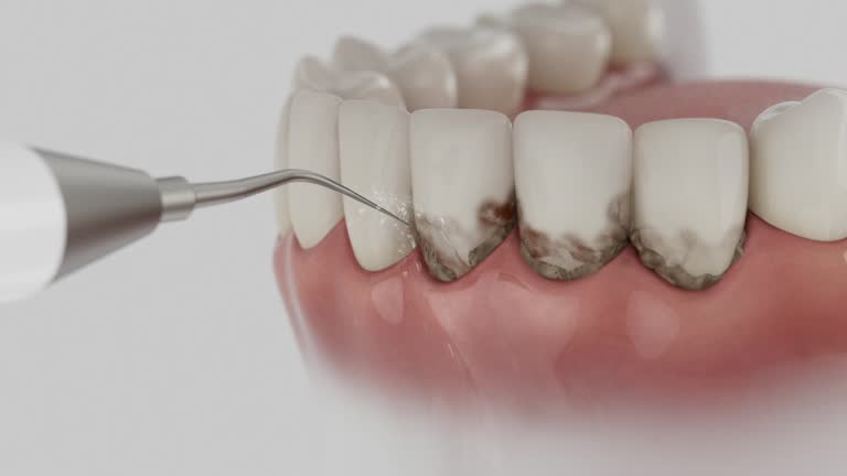 Reliable Teeth Cleaning And Checkup contractor in Peach County County, GA by Dentist Open Now